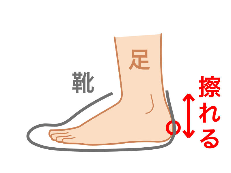 靴と足が擦れるパターン